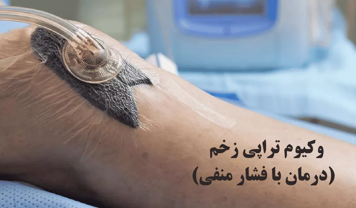 وکیوم تراپی زخم
