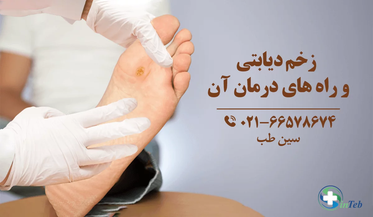 درمان زخم دیابتی