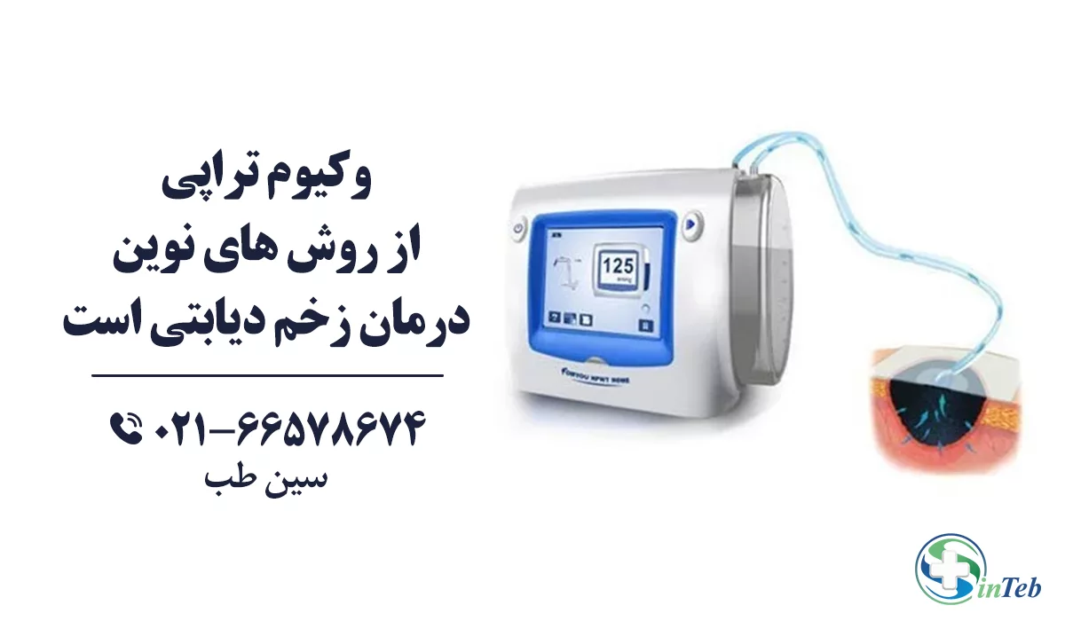 دستگاه وکیوم تراپی زخم دیابتی