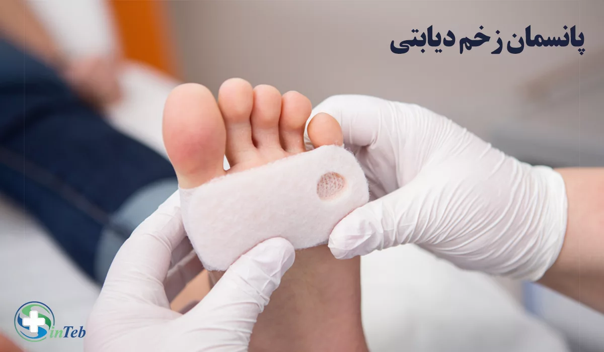 پانسمان زخم دیابتی