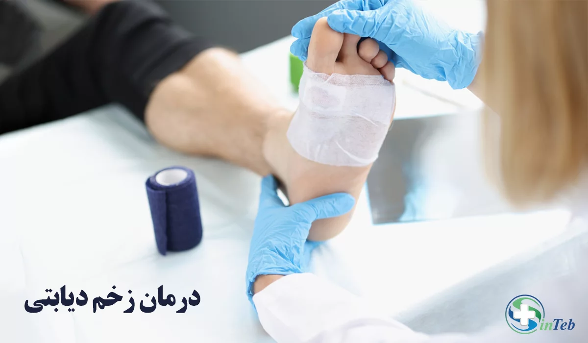 درمان زخم دیابتی