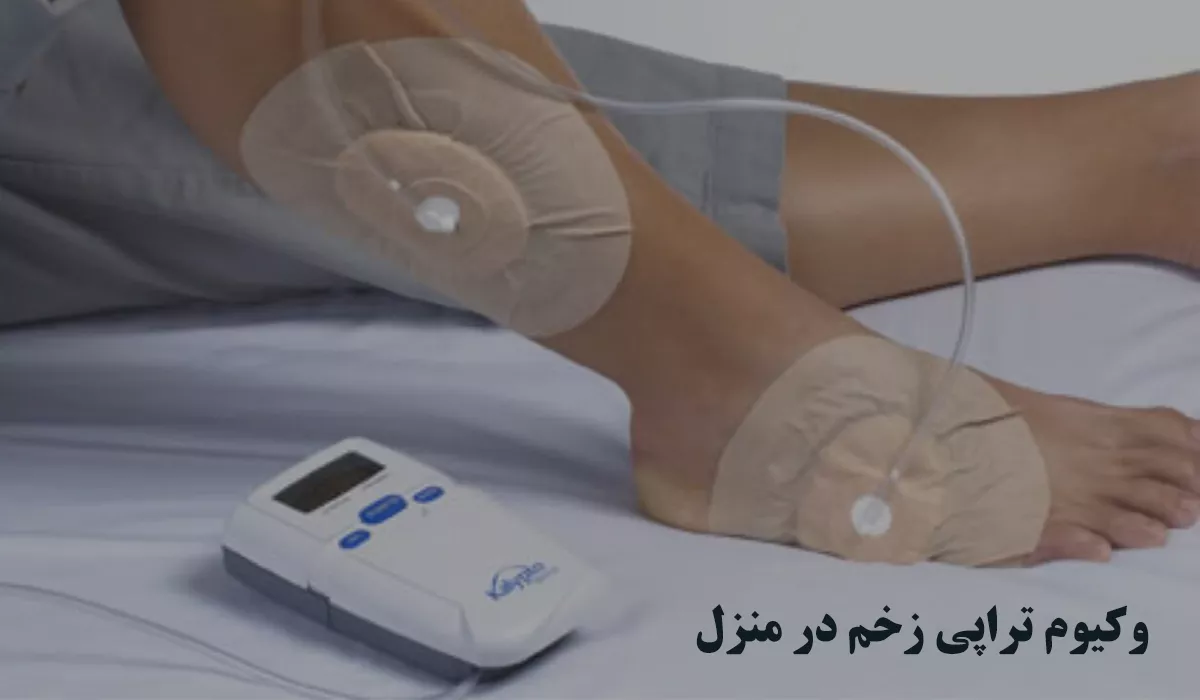 وکیوم تراپی زخم در منزل