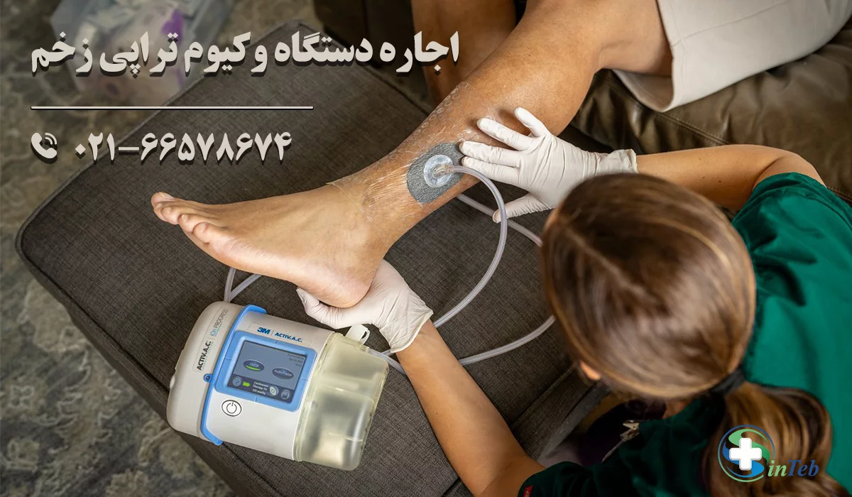 اجاره دستگاه وکیوم تراپی زخم