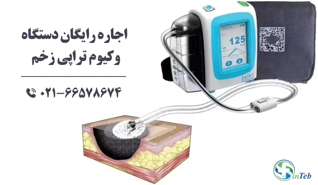 اجاره رایگان دستگاه وکیوم تراپی زخم تهران