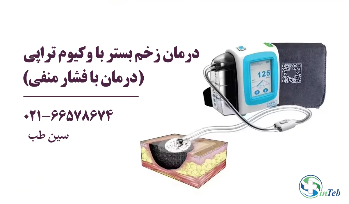 درمان زخم بستر با وکیوم تراپی