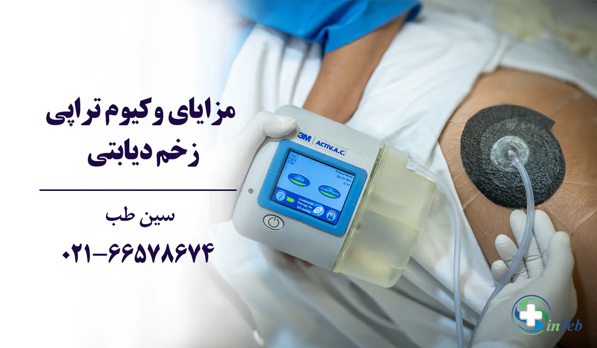 مزایای درمان زخم دیابتی با وکیوم تراپی