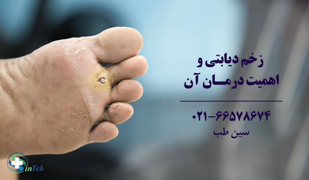زخم دیابتی و اهمیت درمان آن