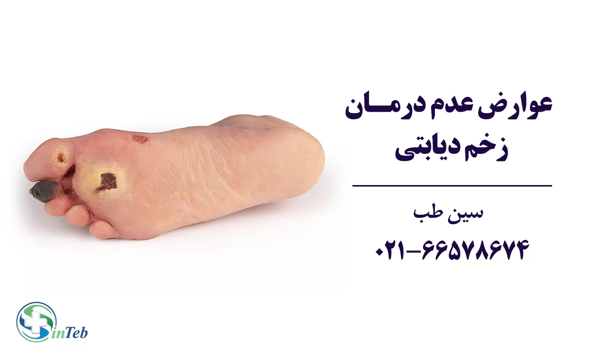 عوارض عدم درمان زخم دیابتی