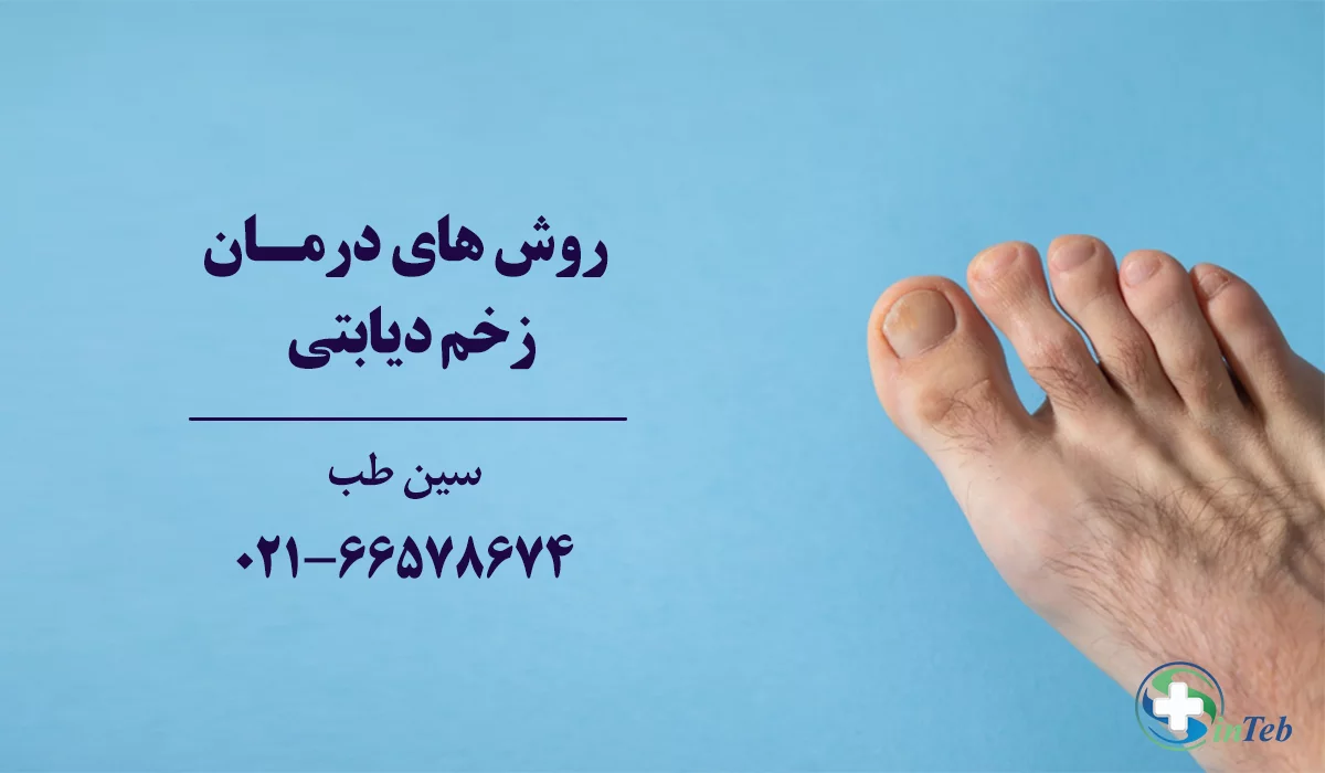 روش های درمان زخم دیابتی