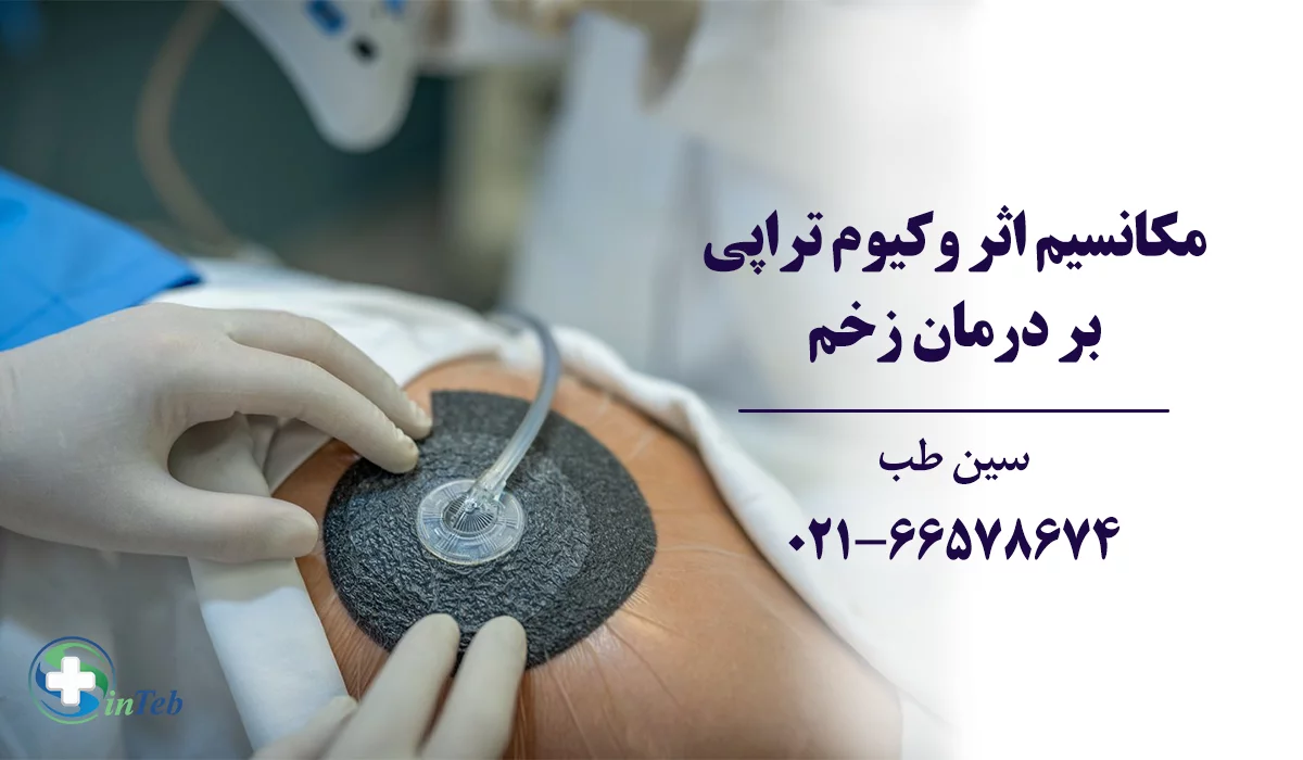 مکانیسم اثر وکیوم تراپی