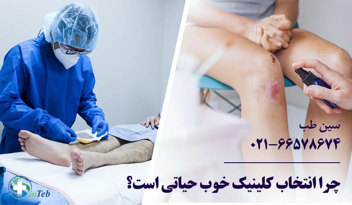 بهترین کلینیک درمان زخم تهران