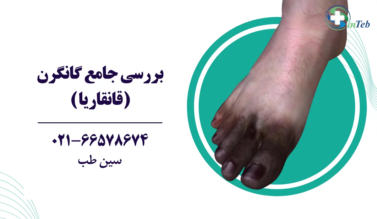گانگرن یا قانقاریا