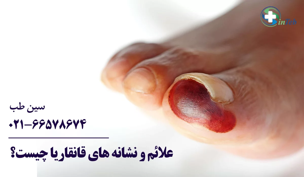 علائم و نشانه های گانگرن یا قانقاریا