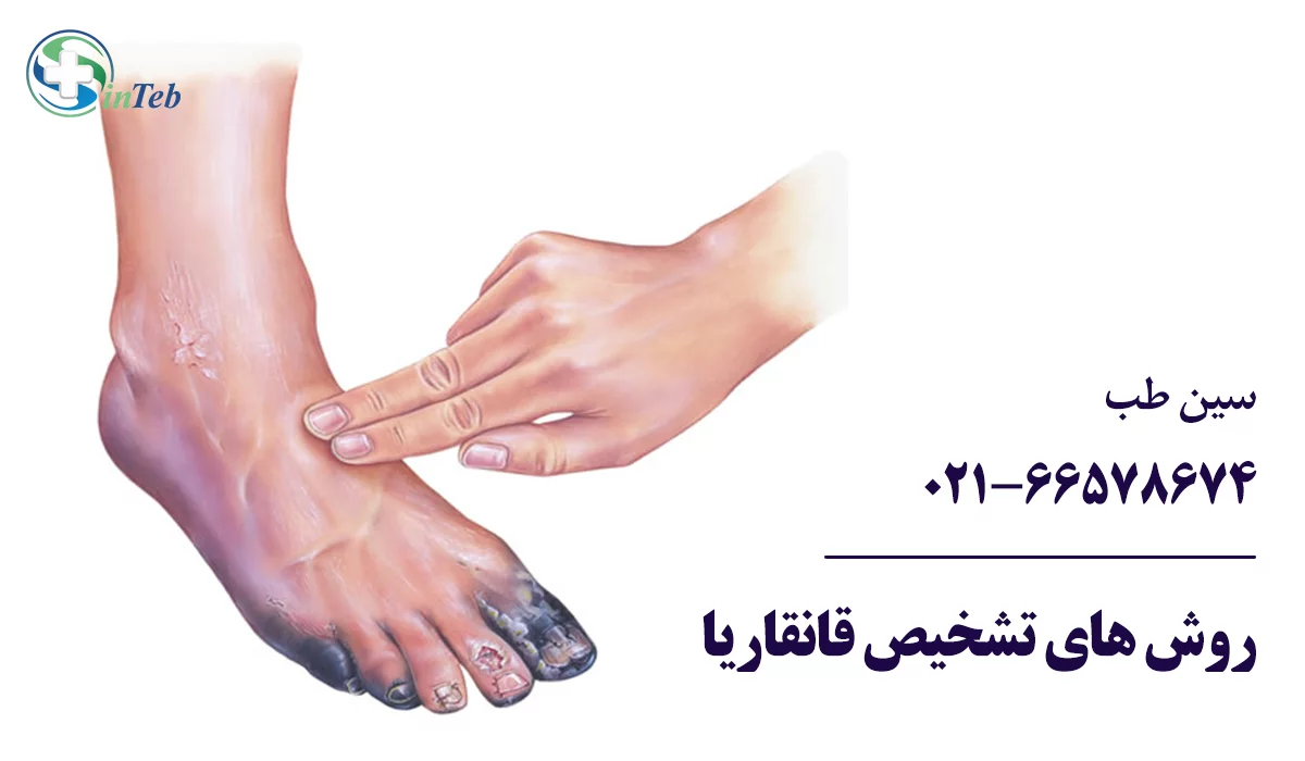 تشخیص گانگرن یا قانقاریا