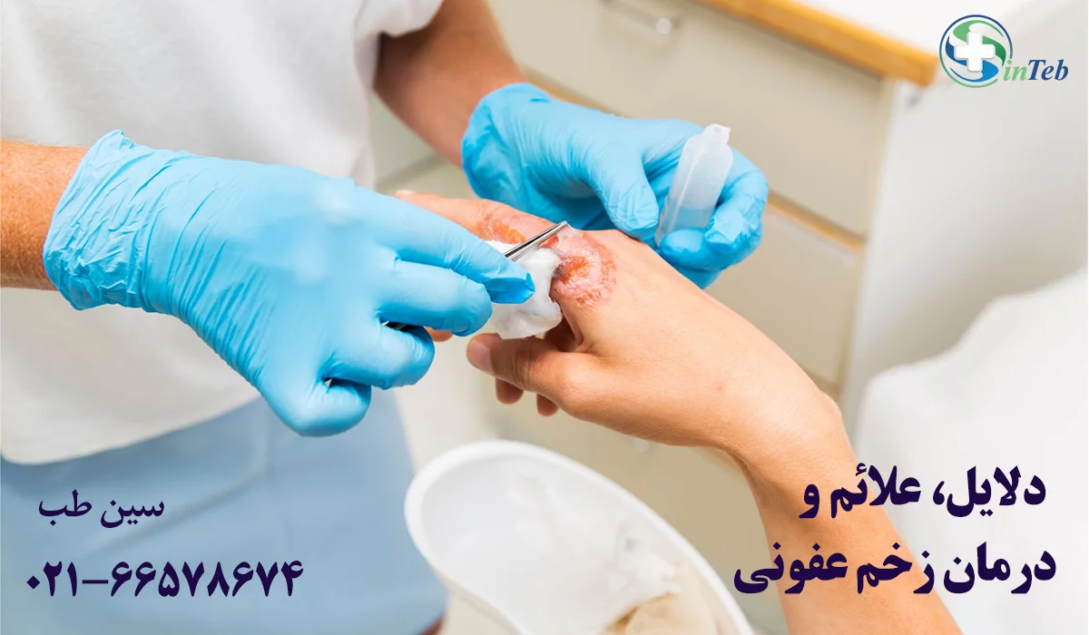درمان زخم عفونی 