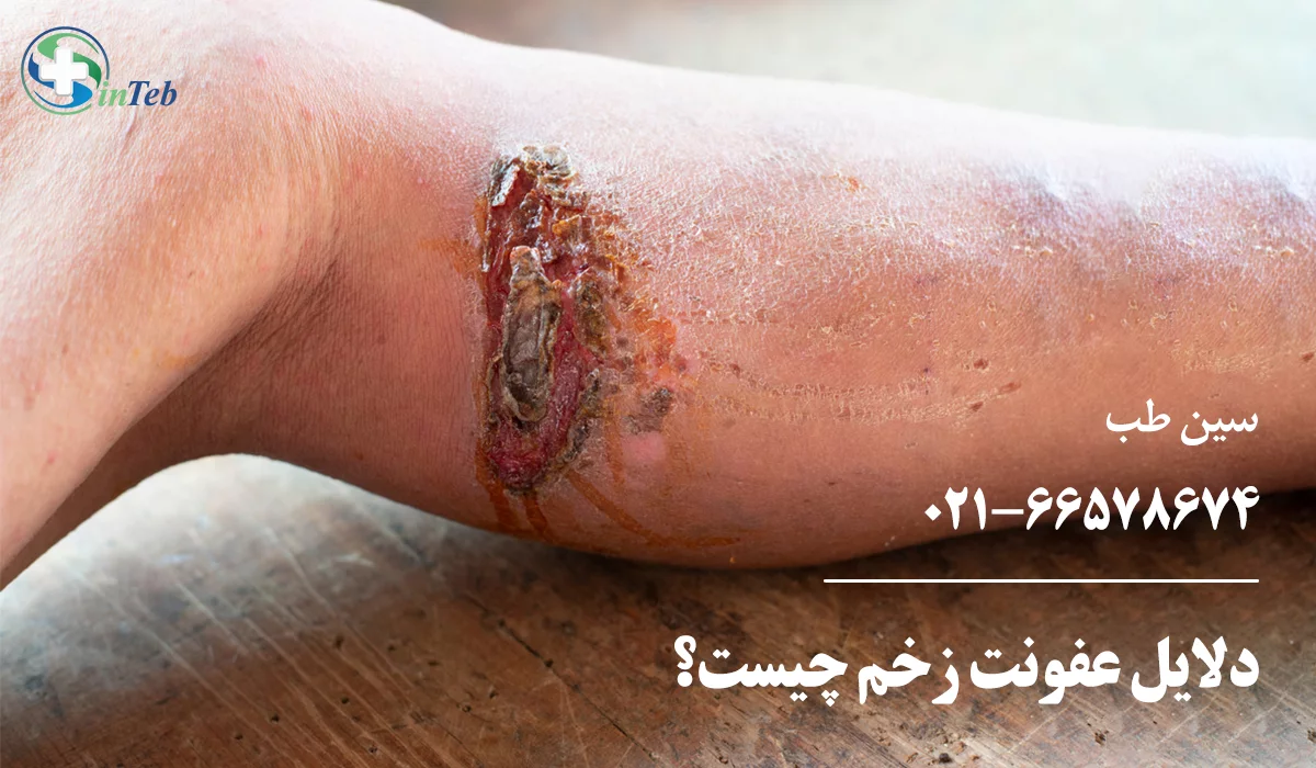 دلایل زخم عفونی