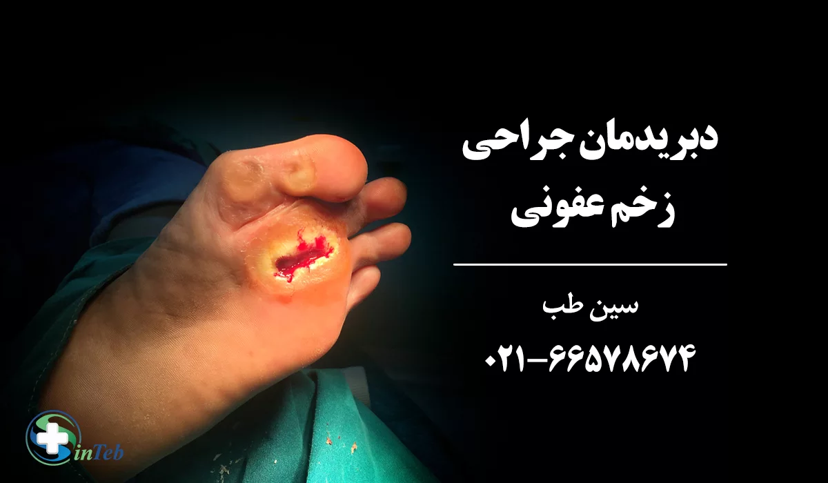 درمان زخم عفونی دبریدمان