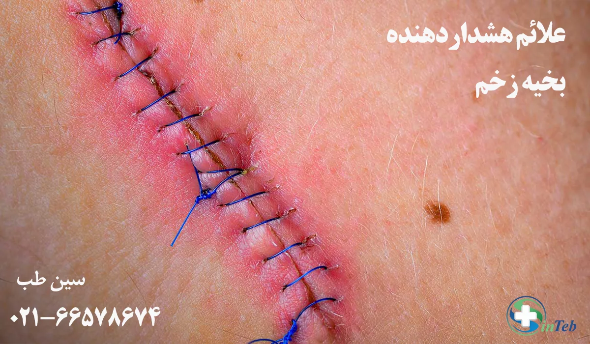 علائم هشدار بخیه زخم