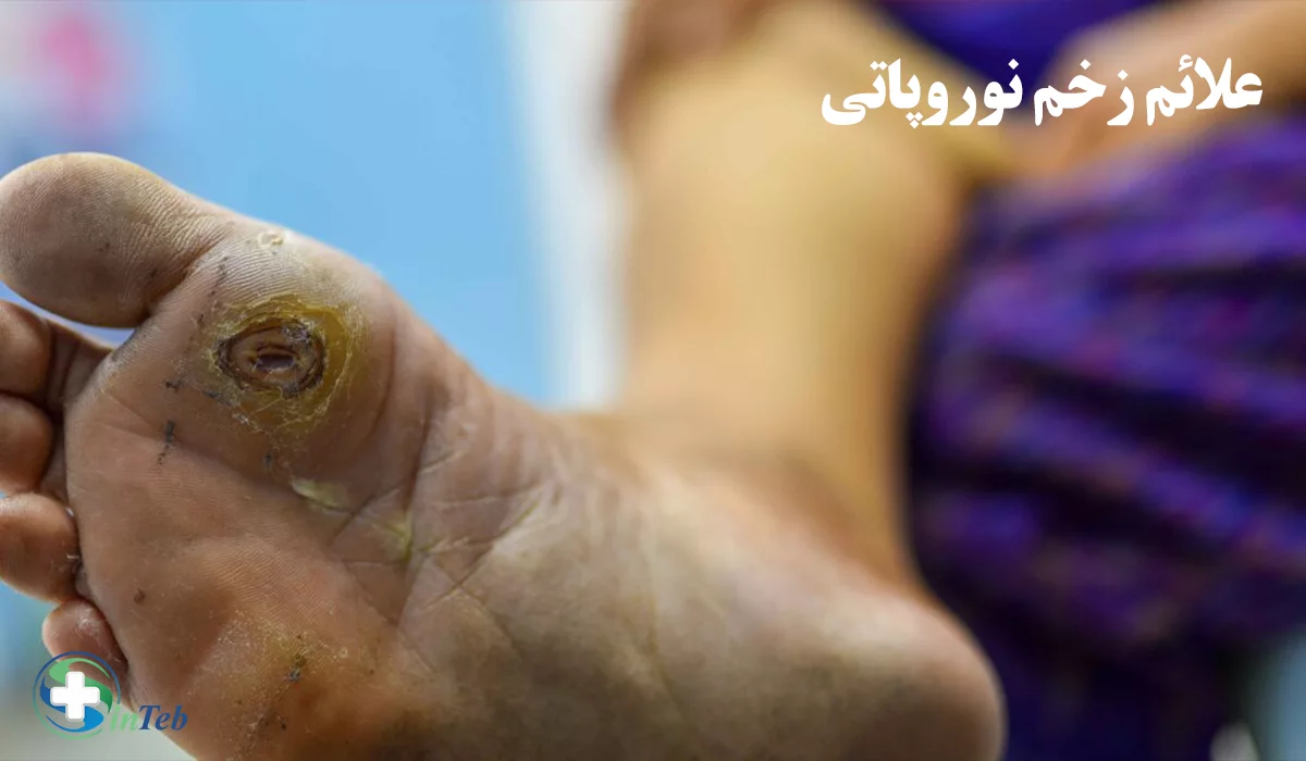 علائم زخم نوروپاتی