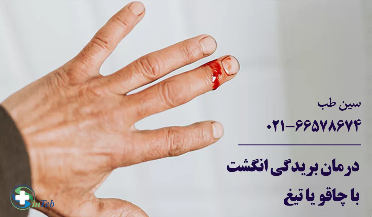 بریدگی انگشت دست با چاقو