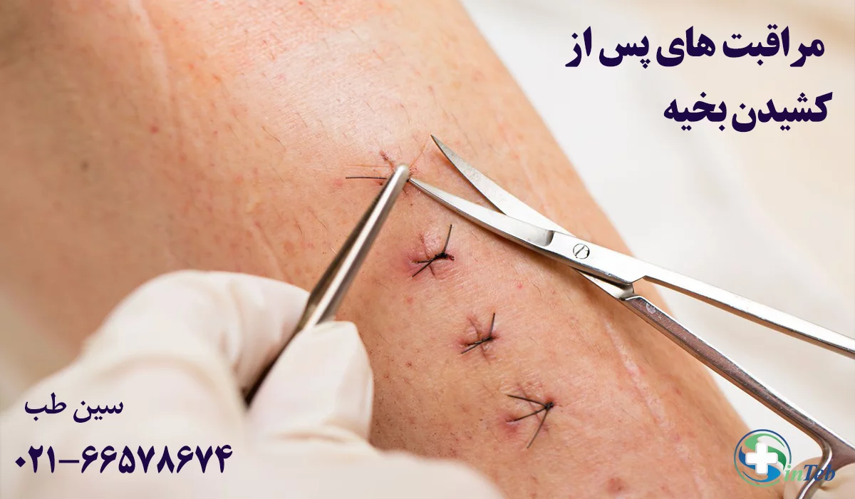 مراقبت های جوش خوردن بخیه زخم پس از کشیدن