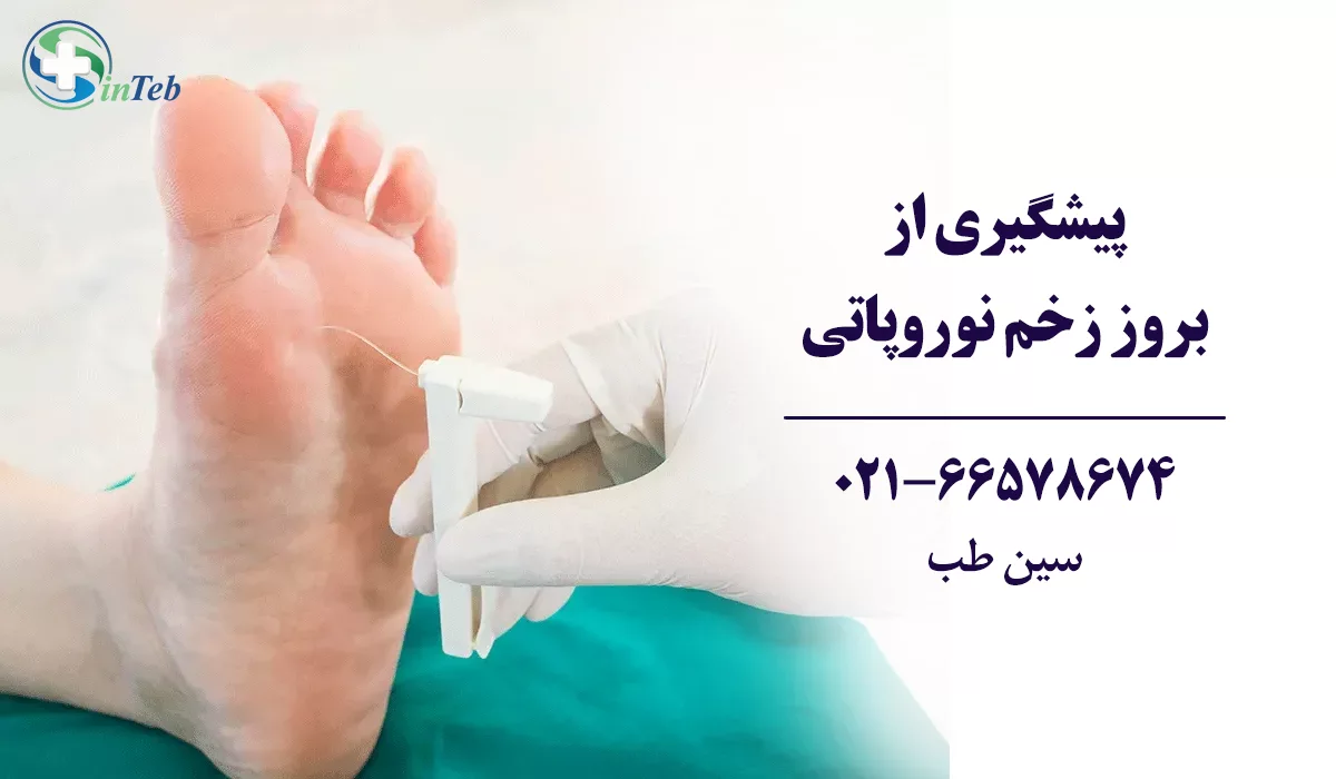پیشگیری از زخم نوروپاتی